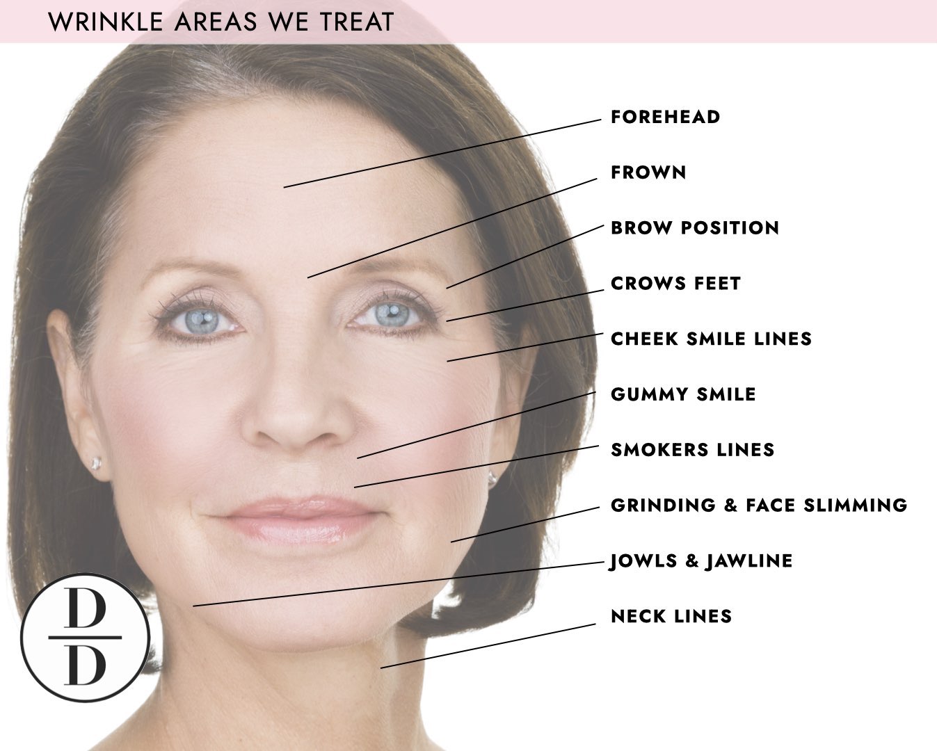 anti wrinkle treatment areas