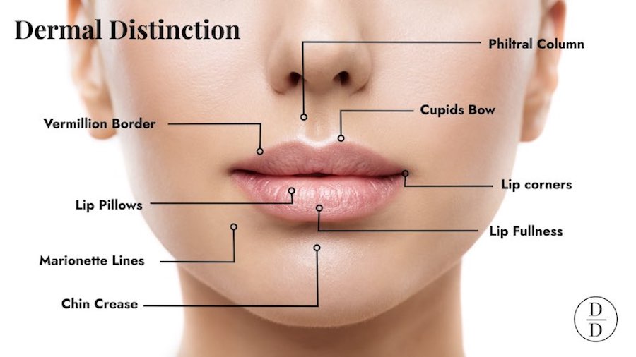 natural lip filler injections melbourne